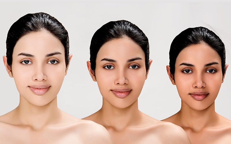 Skin Lightening Treatment Cost