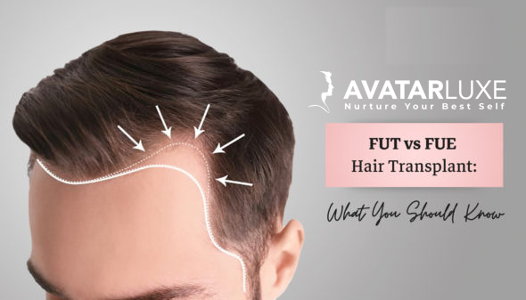 FUT Hair Transplant Vs FUE Hair Transplant in Bangalore