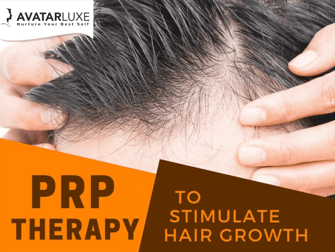 prp treatment