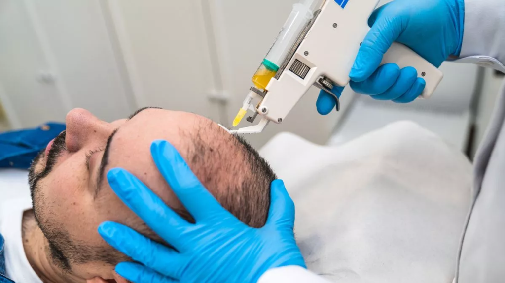 Innovations in Hair Transplantation