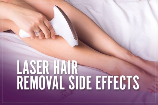 Laser-hair-removal-side-effects